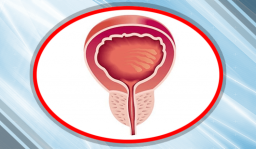 Что необходимо знать всем мужчинам старше 35. Увеличение простаты