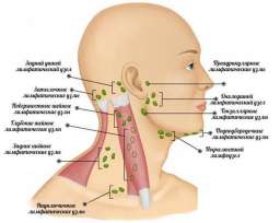 Что может вызвать воспаление. Увеличенные лимфоузлы