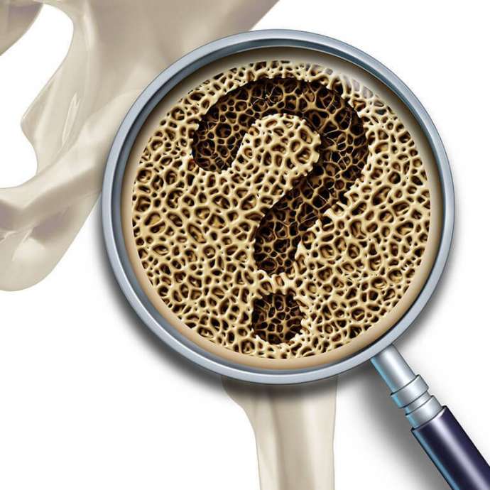 5 главные признаки остеопороза, которые важно не пропустить на раннем этапе