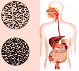 Как остеопороз связан с работой кишечника. Хрупкие отношения